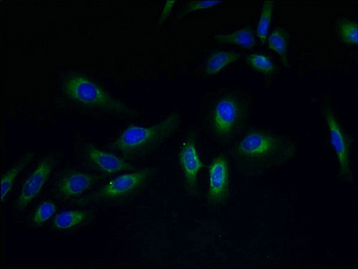 PVRIG Antibody - Immunofluorescent analysis of Hela cells using PVRIG Antibody at dilution of 1:100 and Alexa Fluor 488-congugated AffiniPure Goat Anti-Rabbit IgG(H+L)