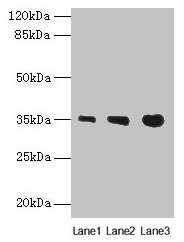 PVRIG Antibody - Western blot All lanes: NAPEPLD antibody at 4µg/ml Lane 1: Mouse liver tissue Lane 2: Mouse kidney tissue Lane 3: Mouse heart tissue Secondary Goat polyclonal to rabbit IgG at 1/10000 dilution Predicted band size: 34 kDa Observed band size: 34 kDa