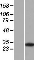 PVRIG Protein - Western validation with an anti-DDK antibody * L: Control HEK293 lysate R: Over-expression lysate