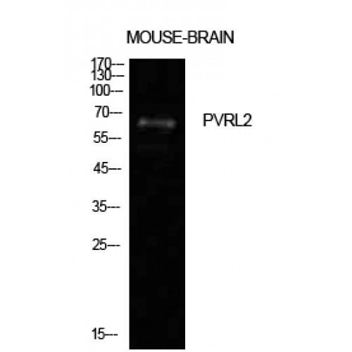 PVRL2 / CD112 Antibody - Western blot of Nectin 2 antibody