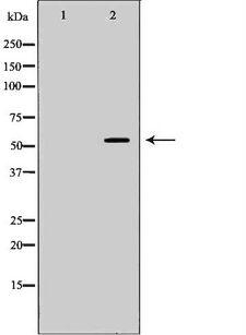 PVRL2 / CD112 Antibody - Western blot analysis of K562 whole cells lysates using PVRL2 antibody. The lane on the left is treated with the antigen-specific peptide.