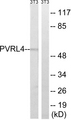 PVRL4 / Nectin 4 Antibody - Western blot analysis of lysates from NIH/3T3 cells, using PVRL4 Antibody. The lane on the right is blocked with the synthesized peptide.