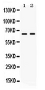 PVRL4 / Nectin 4 Antibody - Western blot analysis of Nectin-4/PVRL4 expression in MCF-7 whole cell lysates and MM453 whole cell lysates. Nectin-4/PVRL4 at 66KD was detected using rabbit anti-Nectin-4/PVRL4 Antigen Affinity purified polyclonal antibody at 0.5 ug/ml. The blot was developed using chemiluminescence (ECL) method.