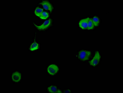 PVRL4 / Nectin 4 Antibody - Immunofluorescence staining of MCF-7 cells diluted at 1:133, counter-stained with DAPI. The cells were fixed in 4% formaldehyde, permeabilized using 0.2% Triton X-100 and blocked in 10% normal Goat Serum. The cells were then incubated with the antibody overnight at 4°C.The Secondary antibody was Alexa Fluor 488-congugated AffiniPure Goat Anti-Rabbit IgG (H+L).