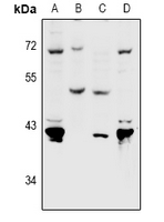 PVRL4 / Nectin 4 Antibody - Western blot analysis of Nectin 4 expression in Hela (A), MCF7 (B), MEF (C), PC12 (D) whole cell lysates.