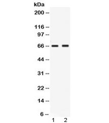 PVRL4 / Nectin 4 Antibody - Western blot testing of human 1) MCF7 and 2) MM453 lysate with Nectin-4 antibody at 0.5ug/ml. Expected molecular weight ~55 kDa (unmodified), ~66 kDa (glycosylated).