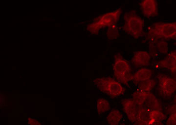 PVRL4 / Nectin 4 Antibody - Staining NIH-3T3 cells by IF/ICC. The samples were fixed with PFA and permeabilized in 0.1% Triton X-100, then blocked in 10% serum for 45 min at 25°C. The primary antibody was diluted at 1:200 and incubated with the sample for 1 hour at 37°C. An Alexa Fluor 594 conjugated goat anti-rabbit IgG (H+L) Ab, diluted at 1/600, was used as the secondary antibody.