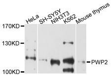 PWP2H / PWP2 Antibody - Western blot analysis of extracts of various cells.