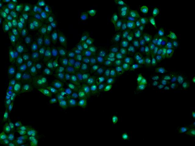 PWP2H / PWP2 Antibody - Immunofluorescence staining of PWP2 in A431 cells. Cells were fixed with 4% PFA, permeabilzed with 0.1% Triton X-100 in PBS, blocked with 10% serum, and incubated with rabbit anti-Human PWP2 polyclonal antibody (dilution ratio 1:200) at 4°C overnight. Then cells were stained with the Alexa Fluor 488-conjugated Goat Anti-rabbit IgG secondary antibody (green) and counterstained with DAPI (blue). Positive staining was localized to Nucleus and Cytoplasm.