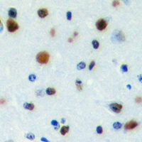 PWWP2B Antibody - Immunohistochemical analysis of PWWP2B staining in human brain formalin fixed paraffin embedded tissue section. The section was pre-treated using heat mediated antigen retrieval with sodium citrate buffer (pH 6.0). The section was then incubated with the antibody at room temperature and detected with HRP and DAB as chromogen. The section was then counterstained with hematoxylin and mounted with DPX.