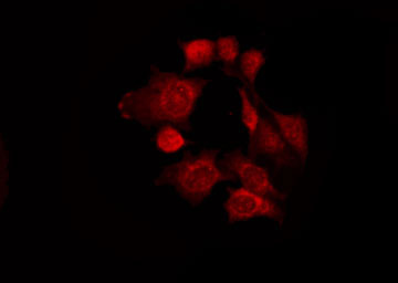 PWWP2B Antibody - Staining LOVO cells by IF/ICC. The samples were fixed with PFA and permeabilized in 0.1% Triton X-100, then blocked in 10% serum for 45 min at 25°C. The primary antibody was diluted at 1:200 and incubated with the sample for 1 hour at 37°C. An Alexa Fluor 594 conjugated goat anti-rabbit IgG (H+L) Ab, diluted at 1/600, was used as the secondary antibody.