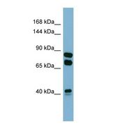 PXDN / MG50 Antibody - Western blot of Human COLO205. PXDN antibody dilution 1.0 ug/ml.  This image was taken for the unconjugated form of this product. Other forms have not been tested.