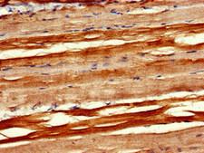 PXK Antibody - Immunohistochemistry image of paraffin-embedded human skeletal muscle tissue at a dilution of 1:100