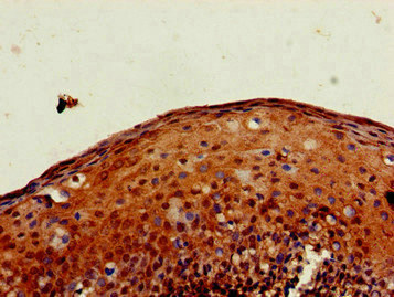PXK Antibody - Immunohistochemistry image of paraffin-embedded human tonsil tissue at a dilution of 1:100
