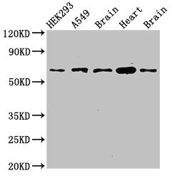 PXK Antibody - Positive Western Blot detected in HEK293 whole cell lysate, A549 whole cell lysate, Mouse brain tissue, Mouse heart tissue, Rat brain tissue. All lanes: PXK antibody at 2.7 µg/ml Secondary Goat polyclonal to rabbit IgG at 1/50000 dilution. Predicted band size: 65, 59, 39, 63, 50, 61, 56 KDa. Observed band size: 65 KDa