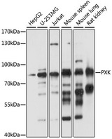 PXK Antibody - Western blot analysis of extracts of various cell lines, using PXK antibody at 1:1000 dilution. The secondary antibody used was an HRP Goat Anti-Rabbit IgG (H+L) at 1:10000 dilution. Lysates were loaded 25ug per lane and 3% nonfat dry milk in TBST was used for blocking. An ECL Kit was used for detection and the exposure time was 10s.