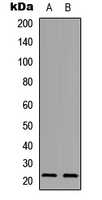 PXMP2 Antibody - Western blot analysis of PXMP2 expression in A549 (A); PC12 (B) whole cell lysates.