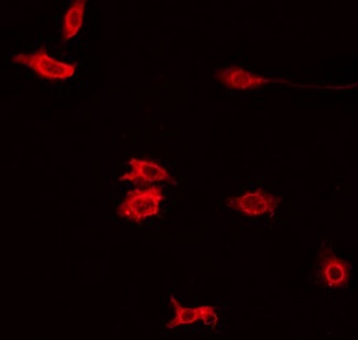 PXMP4 Antibody - Staining HeLa cells by IF/ICC. The samples were fixed with PFA and permeabilized in 0.1% Triton X-100, then blocked in 10% serum for 45 min at 25°C. The primary antibody was diluted at 1:200 and incubated with the sample for 1 hour at 37°C. An Alexa Fluor 594 conjugated goat anti-rabbit IgG (H+L) Ab, diluted at 1/600, was used as the secondary antibody.