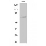 PXN / Paxillin Antibody - Western blot of Phospho-Paxillin (Y31) antibody