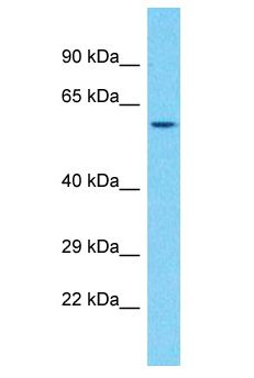 PXN / Paxillin Antibody - PXN / Paxillin antibody Western Blot of ACHN. Antibody dilution: 3 ug/ml.  This image was taken for the unconjugated form of this product. Other forms have not been tested.