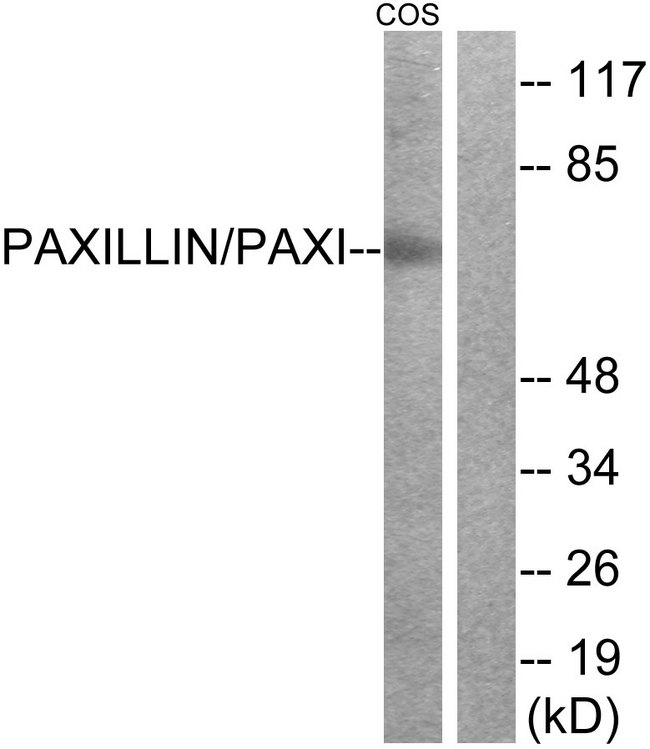 PXN / Paxillin Antibody - Western blot analysis of lysates from COS-7 cells, treated with Estradiol 0.1Î¼M 20', using Paxillin Antibody. The lane on the right is blocked with the synthesized peptide.