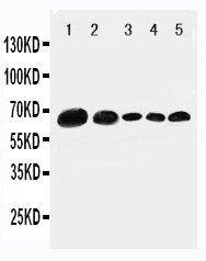 PXN / Paxillin Antibody - WB of PXN / Paxillin antibody. All lanes: Anti-PXN at 0.5ug/ml. Lane 1: 293T Whole Cell Lysate at 40ug. Lane 2: HELA Whole Cell Lysate at 40ug. Lane 3: MCF-7 Whole Cell Lysate at 40ug. Lane 4: MM231 Whole Cell Lysate at 40ug. Lane 5: JUKAT Whole Cell Lysate at 40ug. Predicted bind size: 65KD. Observed bind size: 65KD.