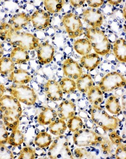 PXN / Paxillin Antibody - PXN / Paxillin antibody. IHC(F): Rat Kidney Tissue.