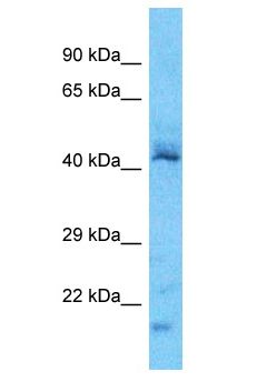 PXN / Paxillin Antibody - PXN / Paxillin antibody Western Blot of A549. Antibody dilution: 1 ug/ml.  This image was taken for the unconjugated form of this product. Other forms have not been tested.