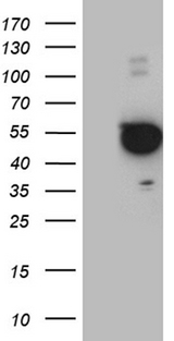 PXN / Paxillin Antibody - HEK293T cells were transfected with the pCMV6-ENTRY control. (Left lane) or pCMV6-ENTRY PXN. (Right lane) cDNA for 48 hrs and lysed. Equivalent amounts of cell lysates. (5 ug per lane) were separated by SDS-PAGE and immunoblotted with anti-PXN. (1:2000)
