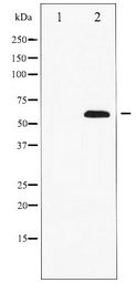 PXN / Paxillin Antibody - Western blot of Paxillin expression in HeLa whole cell lysates,The lane on the left is treated with the antigen-specific peptide.