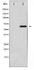 PXN / Paxillin Antibody - Western blot of Paxillin expression in Estradiol treated SK-OV3 whole cell lysates,The lane on the left is treated with the antigen-specific peptide.