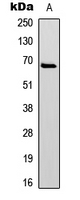 PXN / Paxillin Antibody - Western blot analysis of Paxillin (pY31) expression in HeLa TNFa-treated (A) whole cell lysates.