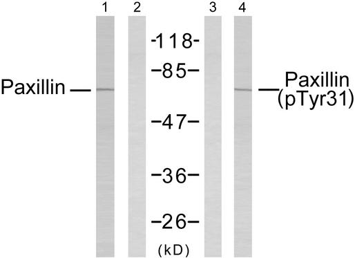 PXN / Paxillin Antibody - Western blot analysis of extracts from SK-OV3 cells untreated or estradiol-treated (0.1µM, 20min), using Paxillin (Ab-31) antibody (Line 1 and 2) and Paxillin (phospho-Tyr31) antibody (Line 3 and 4).