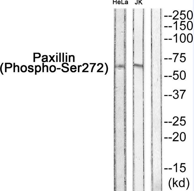 PXN / Paxillin Antibody - Western blot of extracts from HeLa and JK, using Paxillin (Phospho-Ser272) Antibody.
