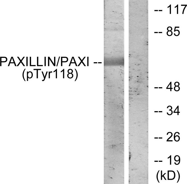 PXN / Paxillin Antibody - Western blot analysis of lysates from HeLa cells treated with EGF, using Paxillin (Phospho-Tyr118) Antibody. The lane on the right is blocked with the phospho peptide.