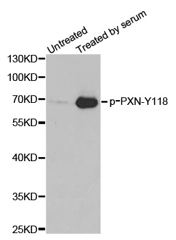 PXN / Paxillin Antibody - Western blot analysis of extracts from 3T3 cells.