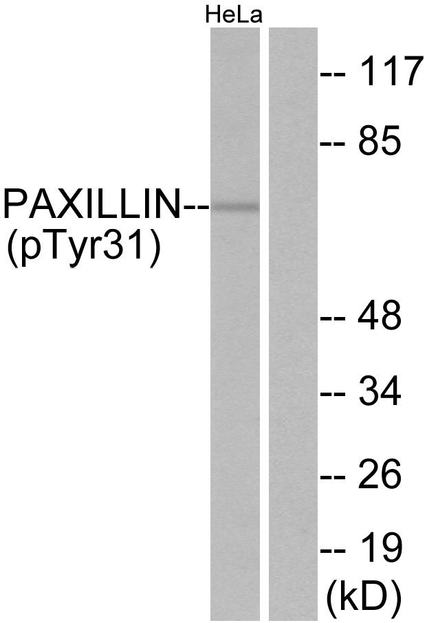 PXN / Paxillin Antibody - Western blot analysis of lysates from HeLa cells treated with TNF 200ng/ml 2', using Paxillin (Phospho-Tyr31) Antibody. The lane on the right is blocked with the phospho peptide.