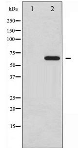 PXN / Paxillin Antibody - Western blot of Paxillin phosphorylation expression in Estradiol treated SK-OV3 whole cell lysates,The lane on the left is treated with the antigen-specific peptide.