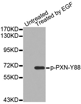 PXN / Paxillin Antibody - Western blot analysis of extracts from HT29 cells.