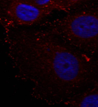 PXN / Paxillin Antibody - Immunofluorescence staining of methanol-fixed Hela cells.