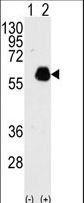 PXN / Paxillin Antibody - Western blot of PXN(arrow) using rabbit polyclonal PXN Antibody (Y118). 293 cell lysates (2 ug/lane) either nontransfected (Lane 1) or transiently transfected with PXN gene (Lane 2) (Origene Technologies).