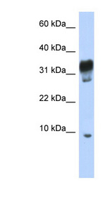 PXT1 Antibody - PXT1 antibody Western blot of Jurkat lysate. This image was taken for the unconjugated form of this product. Other forms have not been tested.