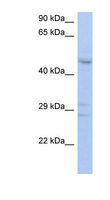 PXYLP1 / ACPL2 Antibody - ACPL2 antibody Western blot of THP-1 cell lysate. This image was taken for the unconjugated form of this product. Other forms have not been tested.