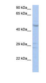 PXYLP1 / ACPL2 Antibody - ACPL2 antibody Western blot of THP-1 cell lysate. This image was taken for the unconjugated form of this product. Other forms have not been tested.
