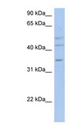 PXYLP1 / ACPL2 Antibody - ACPL2 antibody Western blot of OVCAR-3 cell lysate. This image was taken for the unconjugated form of this product. Other forms have not been tested.
