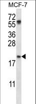 PYCARD / ASC / TMS1 Antibody - PYCARD Antibody western blot of MCF-7 cell line lysates (35 ug/lane). The PYCARD antibody detected the PYCARD protein (arrow).