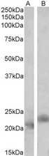 PYCARD / ASC / TMS1 Antibody - PYCARD antibody (2 ug/ml) staining of Mouse (A) and Rat (B) Spleen lysates (35 ug protein in RIPA buffer). Primary incubation was 1 hour. Detected by chemiluminescence.