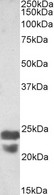 PYCARD / ASC / TMS1 Antibody - PYCARD / ASC / TMS1 antibody (0.5µg/ml) staining of Mouse Spleen lysate (35µg protein in RIPA buffer). Detected by chemiluminescence.