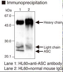 PYCARD / ASC / TMS1 Antibody