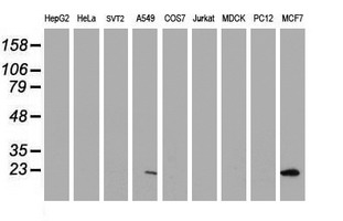 PYCARD / ASC / TMS1 Antibody - Western blot of extracts (35ug) from 9 different cell lines by using anti-PYCARD monoclonal antibody (HepG2: human; HeLa: human; SVT2: mouse; A549: human; COS7: monkey; Jurkat: human; MDCK: canine; PC12: rat; MCF7: human).